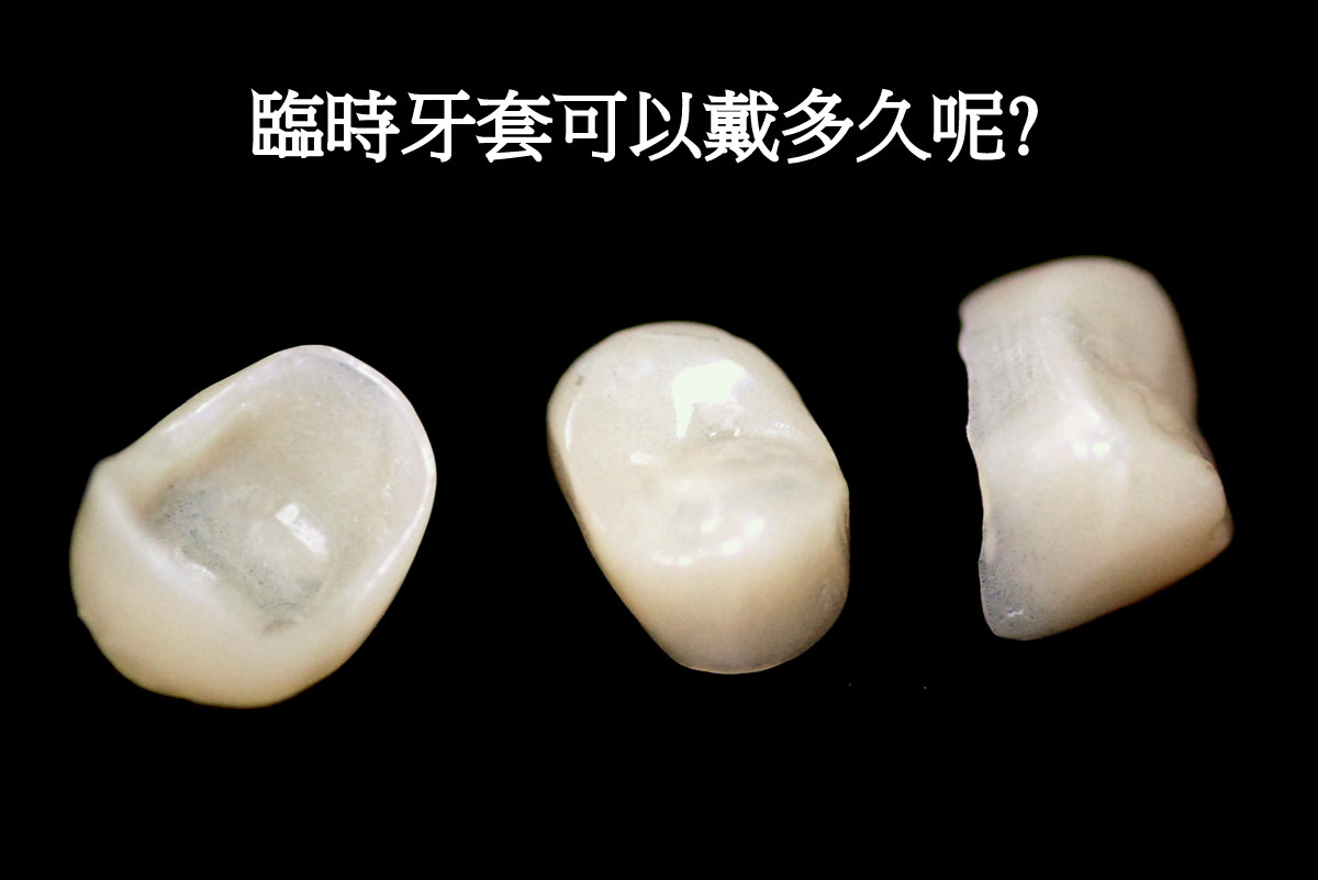 治疗和美白牙齿，牙冠。之前和之后。牙医。特写镜头。照片摄影图片_ID:351777607-Veer图库